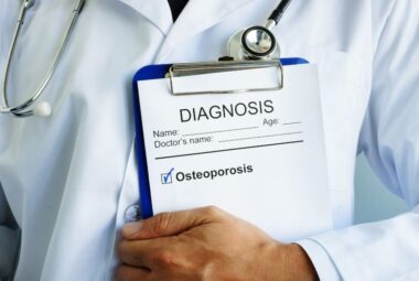 osteoporosis diagnosis