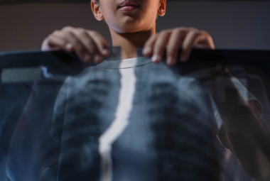 Osteoporosis-Pseudoglioma Syndrome