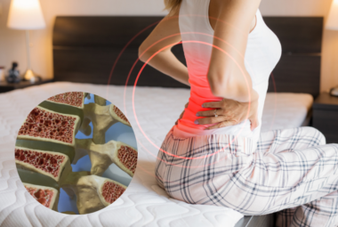 Idiopathic Osteoporosis