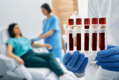 Blood test for osteoporosis