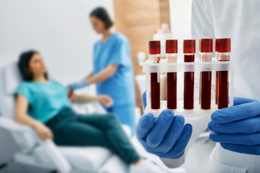 Blood test for osteoporosis