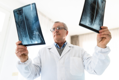 new treatments for osteoporosis