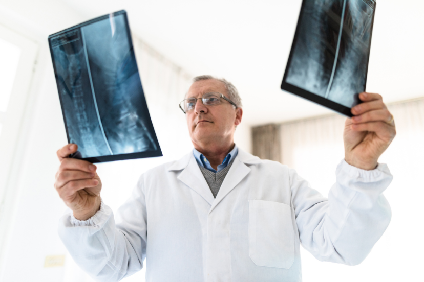 new treatments for osteoporosis