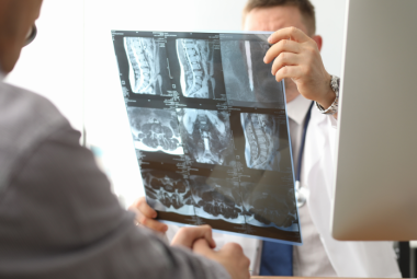 osteoporosis fracture risk