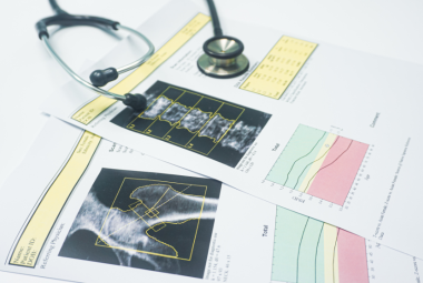 Bone density measurements