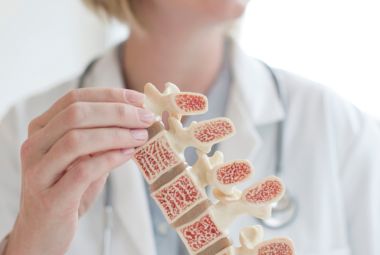 early onset osteoporosis