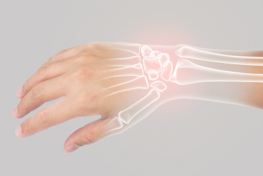 Osteoporosis and bone density loss