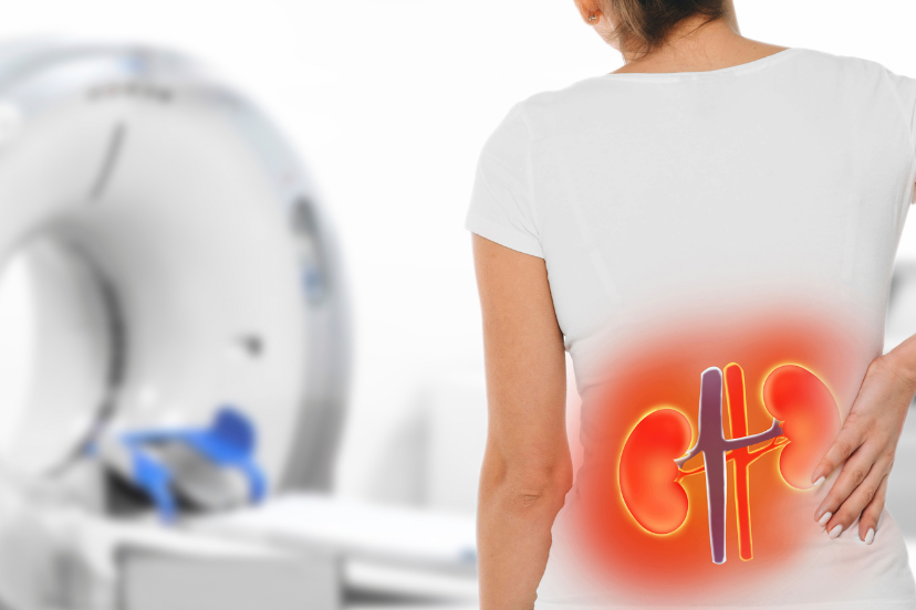 Osteoporosis and kidney disease