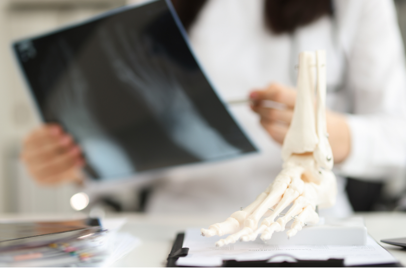 Osteoporosis and bone protection